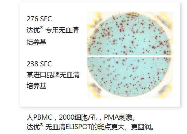 人淋巴細胞無血清培養基-斑點2.jpg